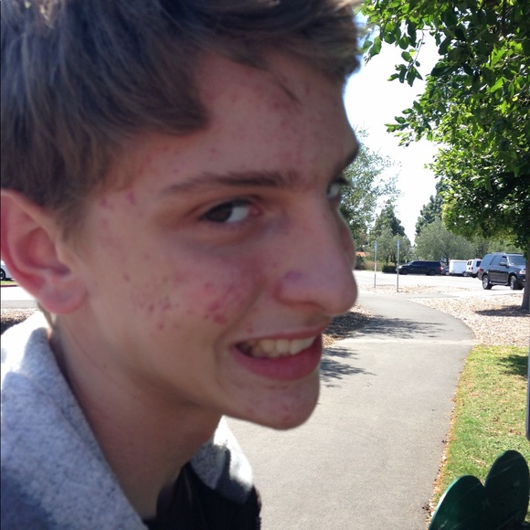 Meet your Posher, Magnus - Picture 1 of 1